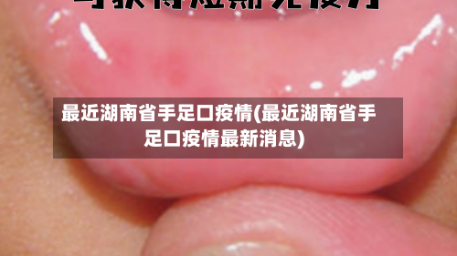 最近湖南省手足口疫情(最近湖南省手足口疫情最新消息)