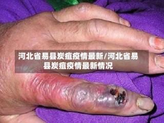 河北省易县炭疽疫情最新/河北省易县炭疽疫情最新情况