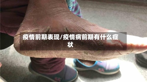 疫情前期表现/疫情病前期有什么症状