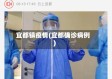 宜都镇疫情(宜都确诊病例)