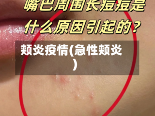 颊炎疫情(急性颊炎)