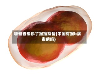 哪些省确诊了猴痘疫情(中国有猴b病毒病吗)