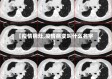 【疫情病灶,疫情病变叫什么名字】