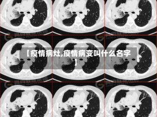 【疫情病灶,疫情病变叫什么名字】