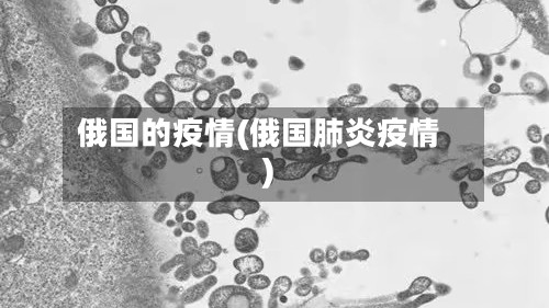 俄国的疫情(俄国肺炎疫情)