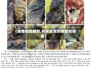 【疫情新闻解剖,有关疫情的新闻的讲解】