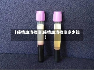 【疫情血清检测,疫情血清检测多少钱】