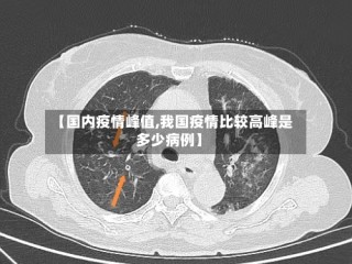 【国内疫情峰值,我国疫情比较高峰是多少病例】