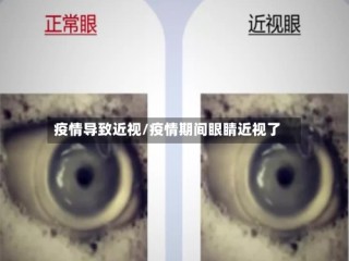 疫情导致近视/疫情期间眼睛近视了