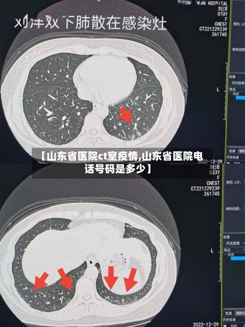 【山东省医院ct室疫情,山东省医院电话号码是多少】-第3张图片