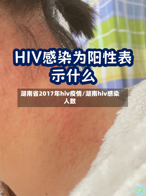 湖南省2017年hiv疫情/湖南hiv感染人数-第1张图片