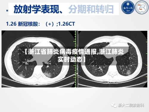 【浙江省肺炎病毒疫情通报,浙江肺炎实时动态】-第2张图片