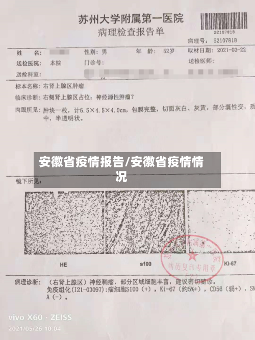 安徽省疫情报告/安徽省疫情情况-第3张图片