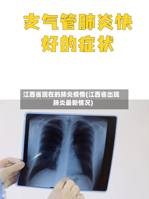 江西省现在的肺炎疫情(江西省出现肺炎最新情况)-第1张图片
