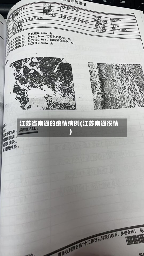 江苏省南通的疫情病例(江苏南通役情)-第1张图片