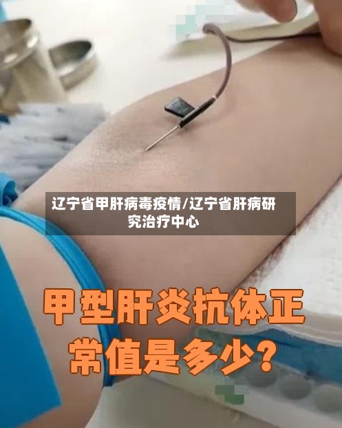 辽宁省甲肝病毒疫情/辽宁省肝病研究治疗中心-第1张图片
