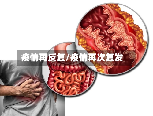 疫情再反复/疫情再次复发-第1张图片