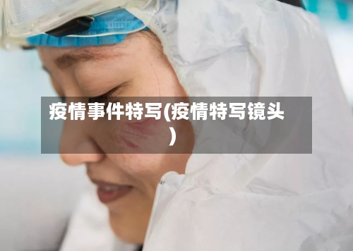 疫情事件特写(疫情特写镜头)-第1张图片