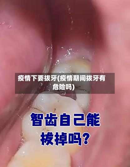 疫情下要拔牙(疫情期间拨牙有危险吗)-第1张图片
