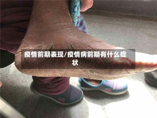 疫情前期表现/疫情病前期有什么症状-第1张图片