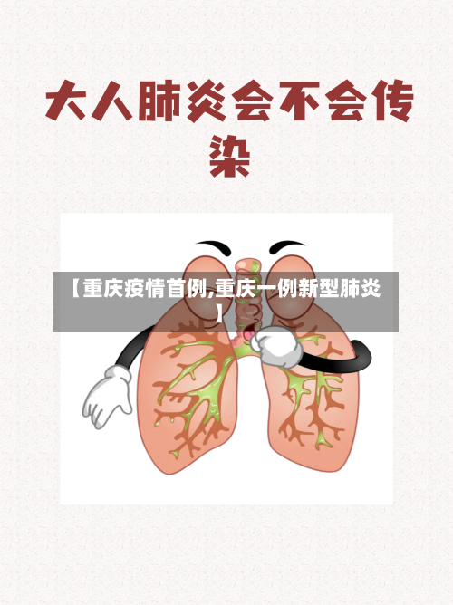 【重庆疫情首例,重庆一例新型肺炎】-第1张图片