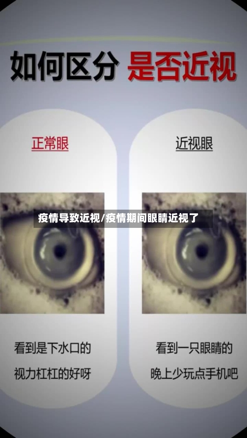 疫情导致近视/疫情期间眼睛近视了-第1张图片