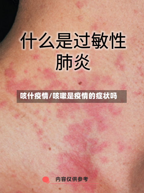 咳什疫情/咳嗽是疫情的症状吗-第2张图片